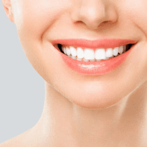 درباره ما 2 Perfect White Teeth Smile Of A Young Woman. The Result Of The Te
