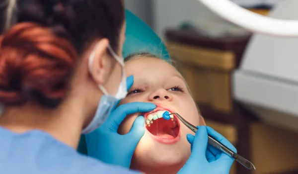 فلوراید ترابی درمان دندان کودکان با فلوراید