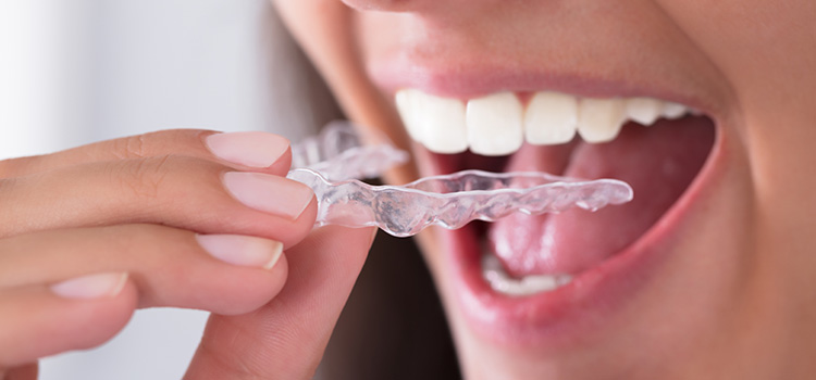 نایت گارد دندان و گارد دندان