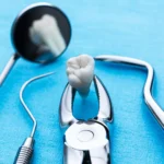 (post-extraction care) مراقبت پس از کشیدن دندان