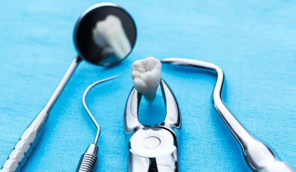 (post-extraction care) مراقبت پس از کشیدن دندان